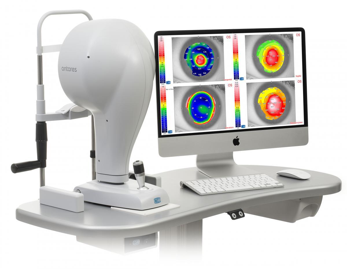 Corneal Topography Test (CTT)