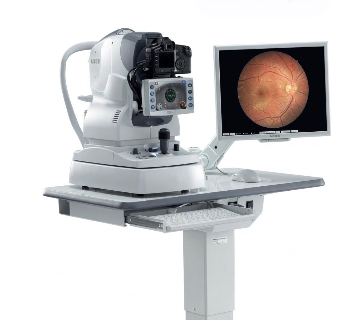 Fundus Camera