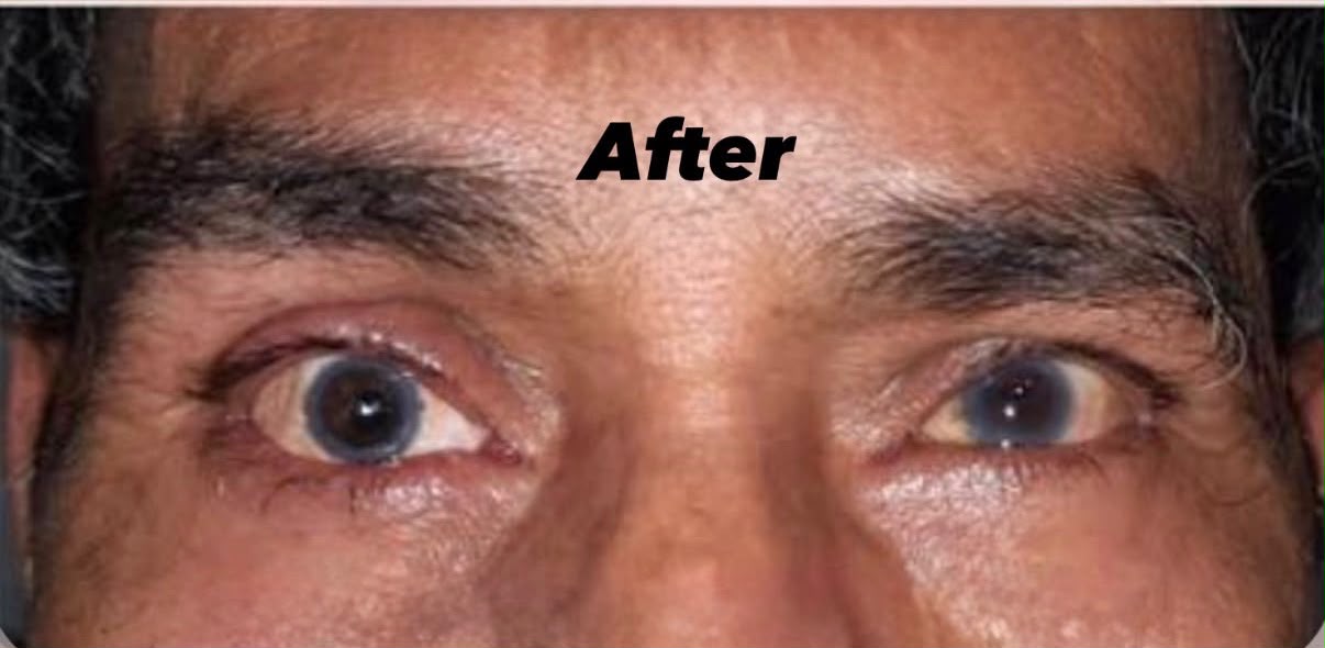 After — Dddd